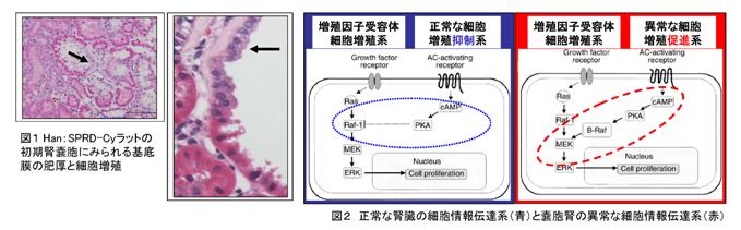 polycystic kidney disease Cy rat PKD XEt